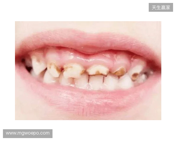 韦林顿确诊上唇部贯通伤;11、21牙半脱位;上颌前牙区牙槽骨骨折 韦林顿确诊上唇部贯通伤;11、21牙半脱位;上颌前牙区牙槽骨骨折